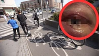Jechała powoli miejską hulajnogą. "Upadek. Wstrząśnienie mózgu. Szczęście, że żyje"