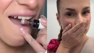 PiĹujÄ zÄby frezarkÄ. "Dentysta robi to samo, ale droĹźej"? Higienistka: MoĹźe dojĹÄ do obumarcia