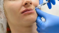 Invisi lips i narrow lips. To koniec ery robionych ust? Teraz chodzi o coĹ zupeĹnie innego