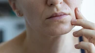 Dodaj szczyptÄ przyprawy do jogurtu i naĹĂłĹź na twarz. Przebarwienia na twarzy zniknÄ