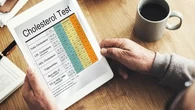 Jangan Abaikan! 5 Faktor Penyebab Kolesterol Tinggi