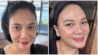 6 Potret Dian Nitami Pasca 3 Minggu Oplas Face Lifting, Kerutan Wajah Berkurang