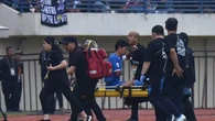 Achmad Jufriyanto Alami Patah 2 Tulang Rusuk Usai Duel Lawan Port FC