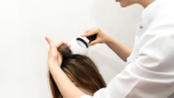 Konsultasi dengan Ahli Dermatologi tentang Rambut Rontok, Apa Saja yang Harus Diperhatikan...