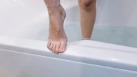 Wajib Tahu Gejala Kaki Diabetik atau Diabetic Foot, Termasuk Kesemutan dan Mati Rasa