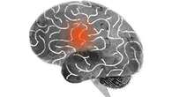 Langkah-Langkah Praktis untuk Mencegah Stroke dan Meningkatkan Kesehatan