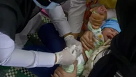 Anggapan Vaksin Polio Tidak Bermanfaat untuk Bayi di Bawah 4 Bulan, Komnas KIPI: Menyesatk...