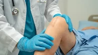 Bagaimana Perawatan Pra dan Pasca Operasi Total Knee Replacement? Ini Penjelasan Dokter Sp...