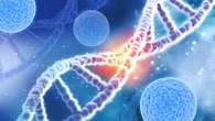 Was-Was Risiko Kena Kanker, Bisa Lho Deteksi DNA di RS Kanker Dharmais