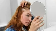 8 Hal yang Perlu Diperhatikan Sebelum Memutuskan untuk Transplantasi Rambut