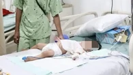 Dirawat di PICU RSUD, Begini Kondisi Terkini Balita yang Keluarkan Cacing dari Mulut-Hidun...