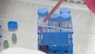 N.S. Health increasing blood collection appointments as patients express frustration