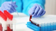 For over 30 years, this small B.C. city has been testing children's blood for lead