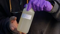 Alberta wastewater unlocked key information about COVID-19. Could it help with measles too?