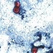 A diarrhea-causing parasite has infected more than 1,000 in the U.S. Is it in Canada?