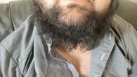 Saskatoon man says he was assaulted, had part of beard cut off in early morning racist attack