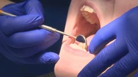 Increase in dental travel to Yellowknife unlikely to slow down anytime soon, says N.W.T. health minister
