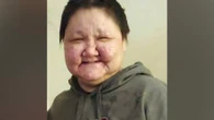 Coroner rules out third-party involvement in death of Inuk woman in Montreal