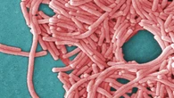 1 dead, more than 40 sick as legionnaires' outbreak spreads in southeast London
