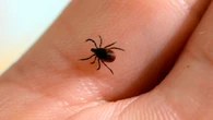 Northern Ontario veterinarian expecting longer, more active tick season