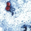 U.S. identifies cyclosporiasis cases in 4 more states, widening investigation