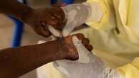 Mpox cases surge in Toronto as Africa declares a health emergency