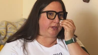 Lipedema patients decry treatment gaps in Canada