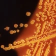 E. coli outbreak at Calgary daycare centres is over, Alberta Health Services says