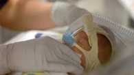 Alberta neonatal intensive care units still under strain, doctors warn