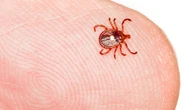 Rare tick-bite allergy leaves Nova Scotia woman unable to eat meat or dairy