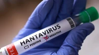 WHO downplays hantavirus pandemic fears as contact tracing ramps up