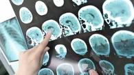 Health P.E.I. has been overpaying Ontario firm for radiology services for years, watchdog says