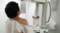 Major overhaul ordered for group that sets Canada's cancer screening guidelines