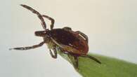 Health unit identifies region's first-ever tick with Anaplasma bacteria