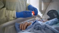 Fewer Albertans dying due to COVID-19, statistics show. But experts warn the risk isn’t gone