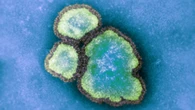 Ontario reports 182 new measles cases, surpassing 1,600 since outbreak began