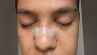Toronto police lay charges following beating of man in Hanlan's Point