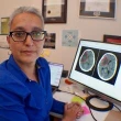 With a 'game changer' stroke treatment in doctors' hands comes a new challenge — shaving off the minutes