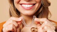 Not just for teens: Why more adults are getting braces in Canada