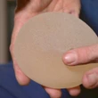 Advocates slam Health Canada's new voluntary breast implant registry, MP 'deeply disappointed'
