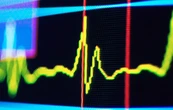 Ритм у пульсі людини може сигналізувати про майбутнє когнітивне погіршення