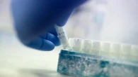 Un donante de semen con un gen cancerígeno concibe 52 hijos en Bélgica