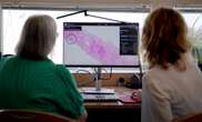 UK hospitals begin live trial of prostate cancer-detecting AI