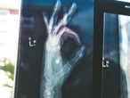 Google’s open MedGemma AI models could transform healthcare