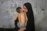 Netanyahu anuncia pausa humanitaria entre condenas por hambruna en Gaza   