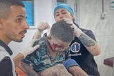 Sufren niños la peor parte  de la guerra en Gaza: estudio   