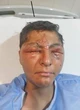 Joven pierde la vista debido a un proyecto escolar sin supervisar   