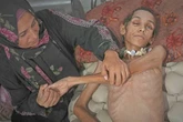 EU exalta labor de centro de ayuda, en donde han matado a cientos de gazatíes   