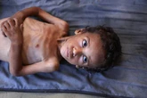 Crece hambruna causada por Israel en Gaza, acusan 100 ONG   