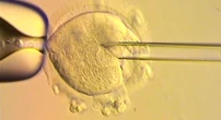 pochi secondi faNascere col DNA di tre personeNel Regno Unito otto bambini sono stati concepiti con due ovuli e uno spermatozoo per evitare malattie ereditarie